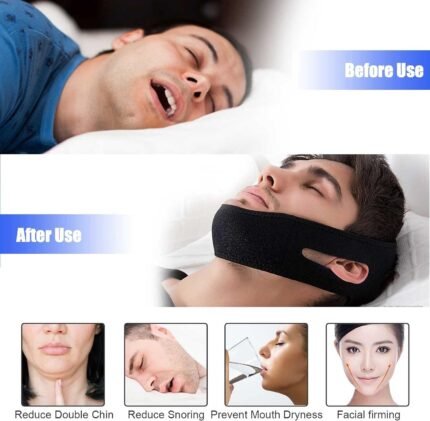 Adjustable Anti-Snore Comfort Fit Chin Strap – Stop Snoring Sleep Aid Device