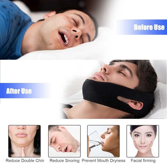 Adjustable Anti-Snore Comfort Fit Chin Strap – Stop Snoring Sleep Aid Device